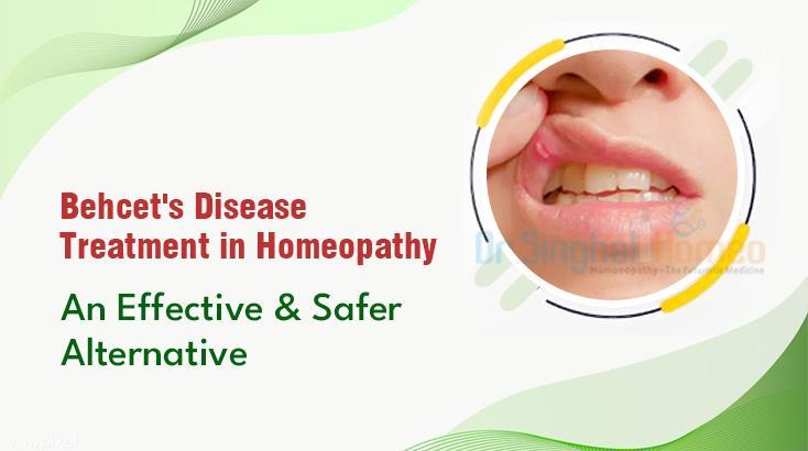 Treatment in Homeopathy